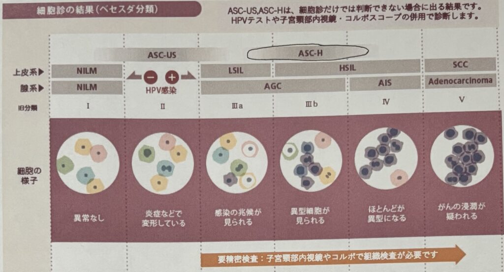 子宮頸がん検診の「要精密検査」ってどんな状態？