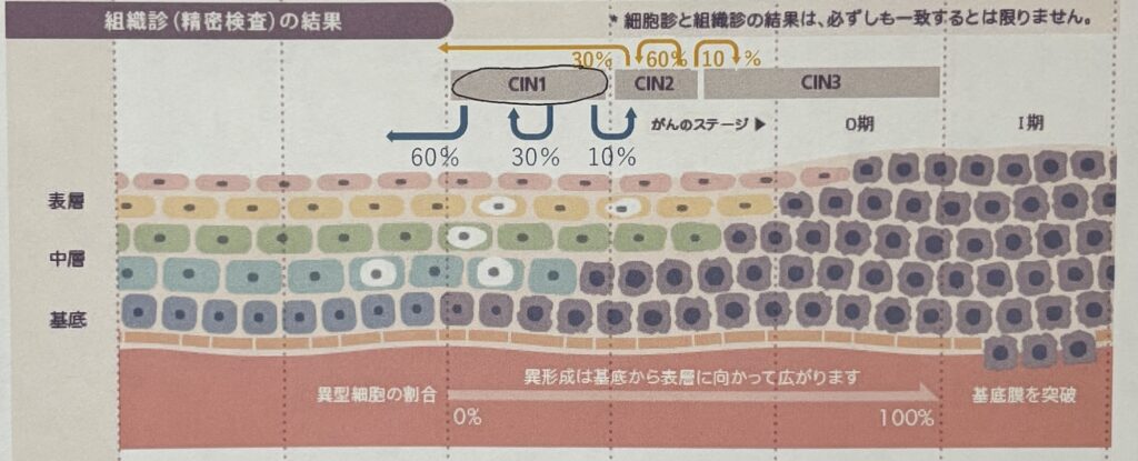 子宮頸がん検査「要精密検査」の結果